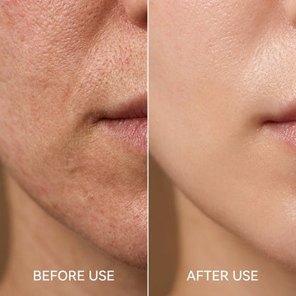 Norzora Wrinkle Free Pro LED Therapy Mask